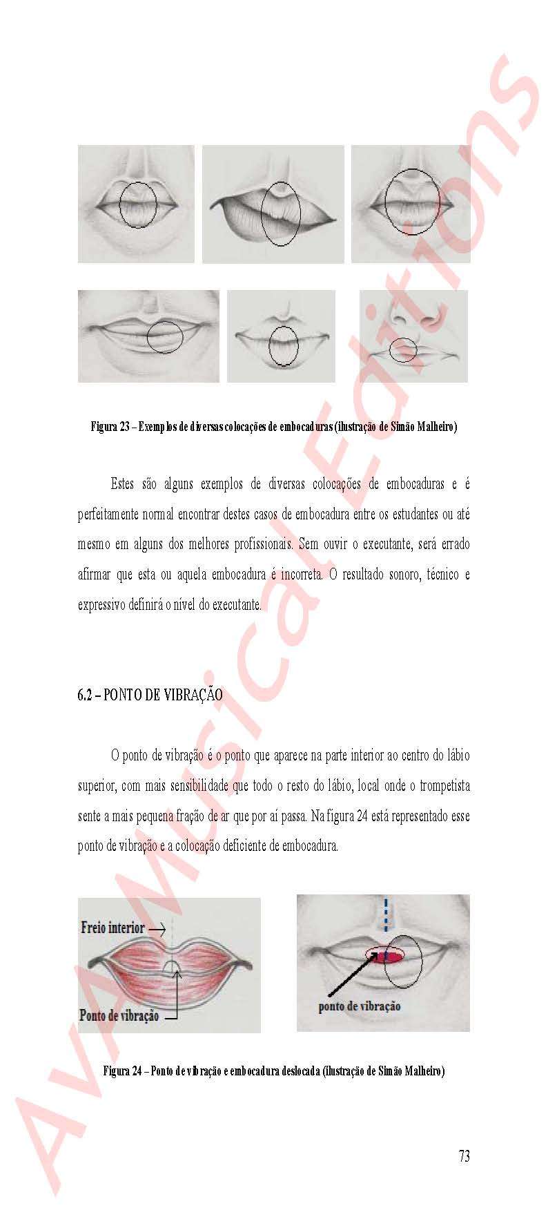 Embocadura do Trompetista - Image 2